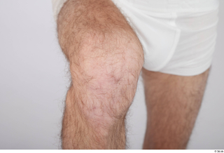 Dio hairy knee nude 0002.jpg